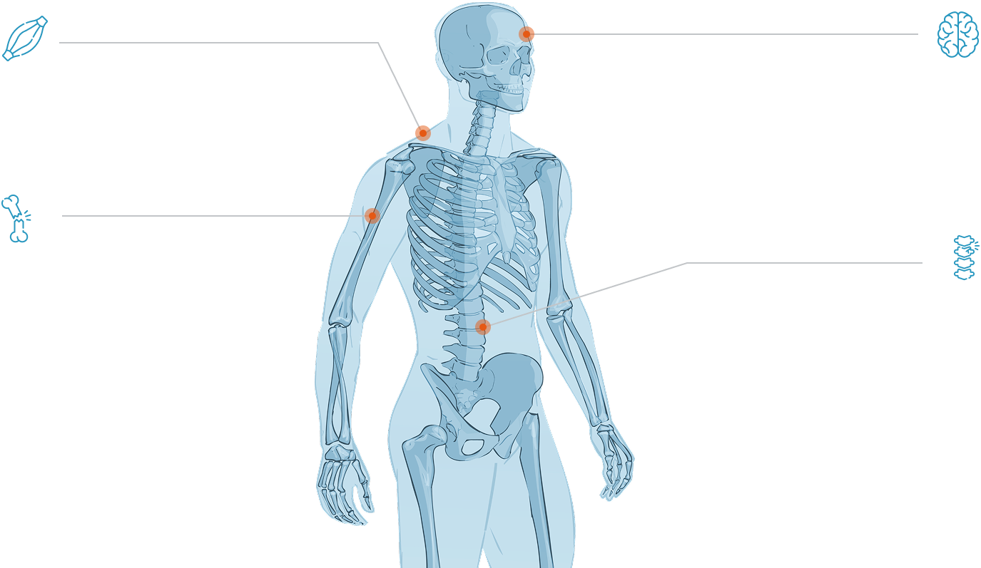 skeleton